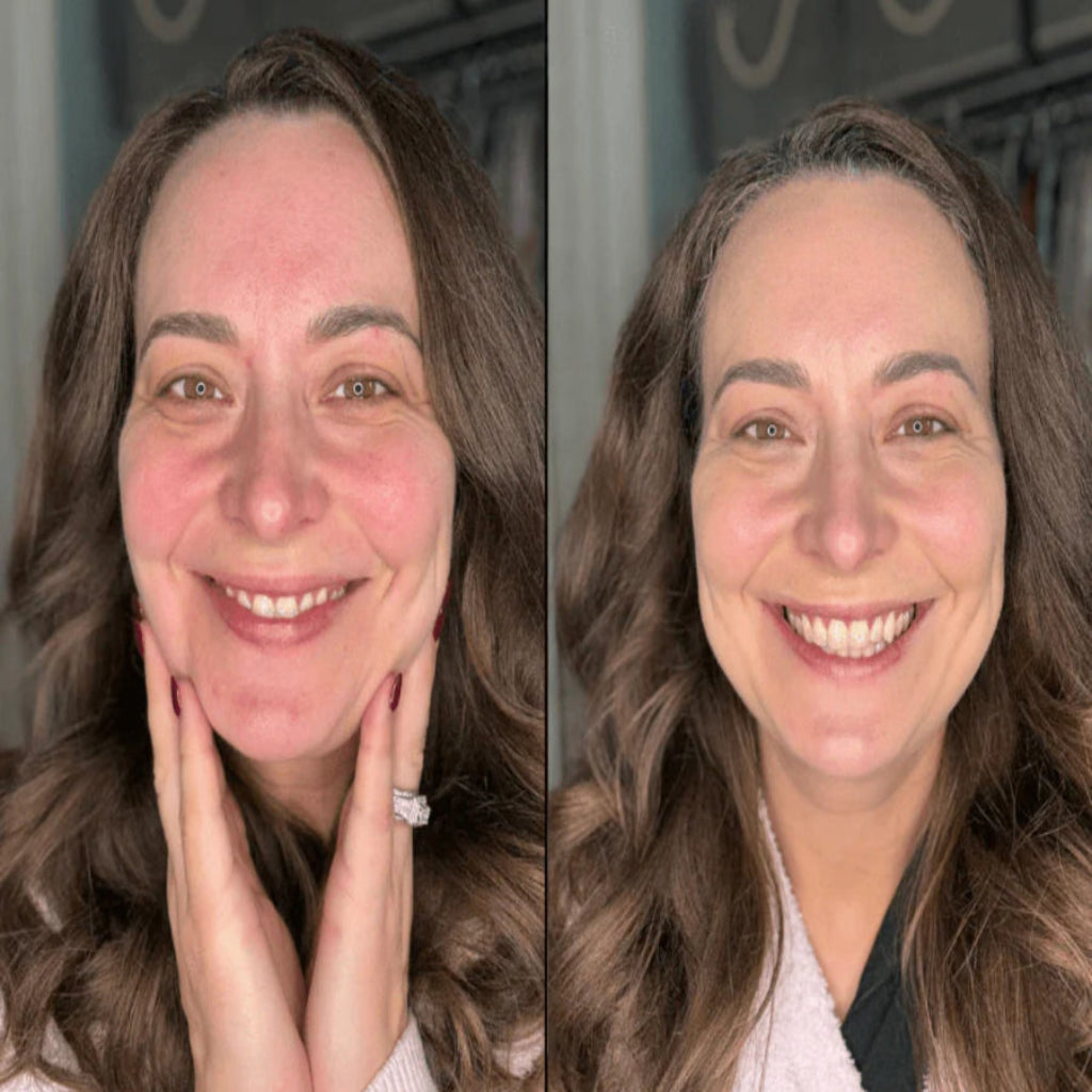 Adaptive Foundation Stick