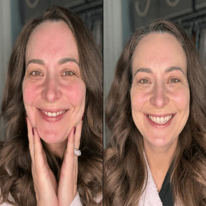 Adaptive Foundation Stick