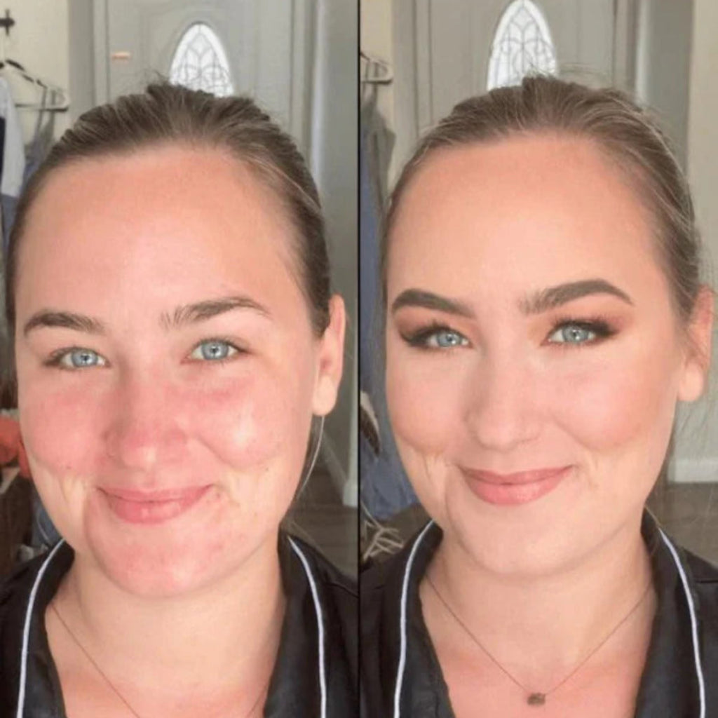 Adaptive Foundation Stick