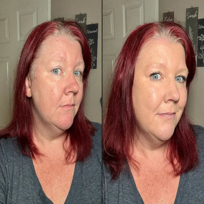 Adaptive Foundation Stick