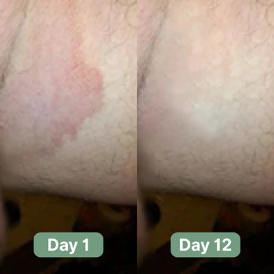 Anti-Bacterial Repair Cream