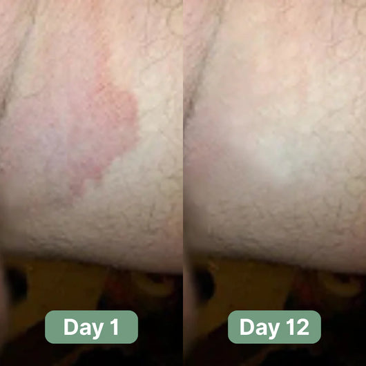 Anti-Bacterial Repair Cream